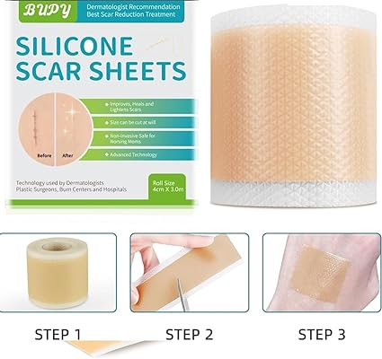 Cinta Parche Eliminación De Cicatrices 150 cm